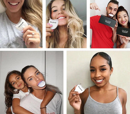 Kit de blanchiment dentaire LED professionnel – Sourire blanc en 14 jours